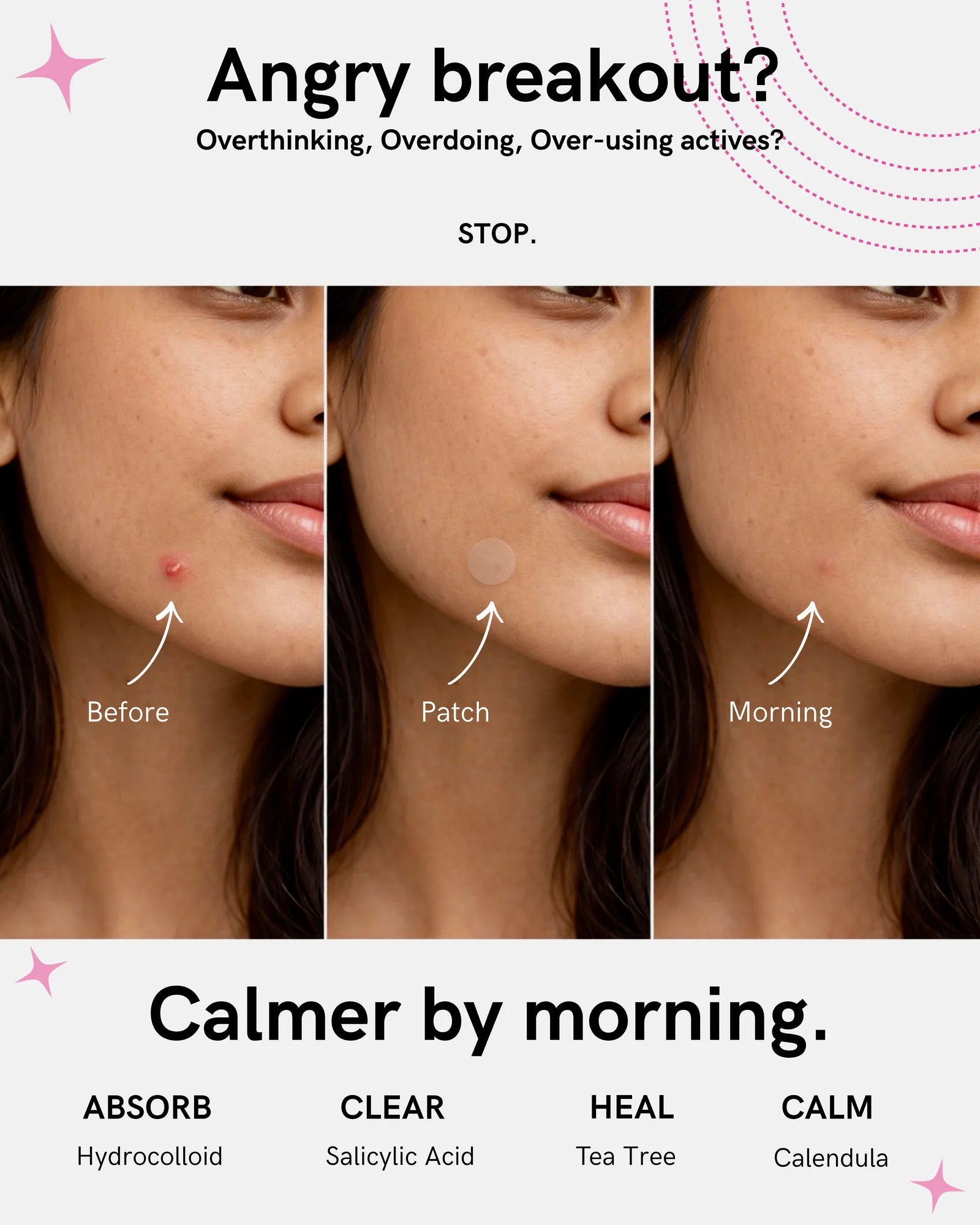 Invisiable- Pimple Patches